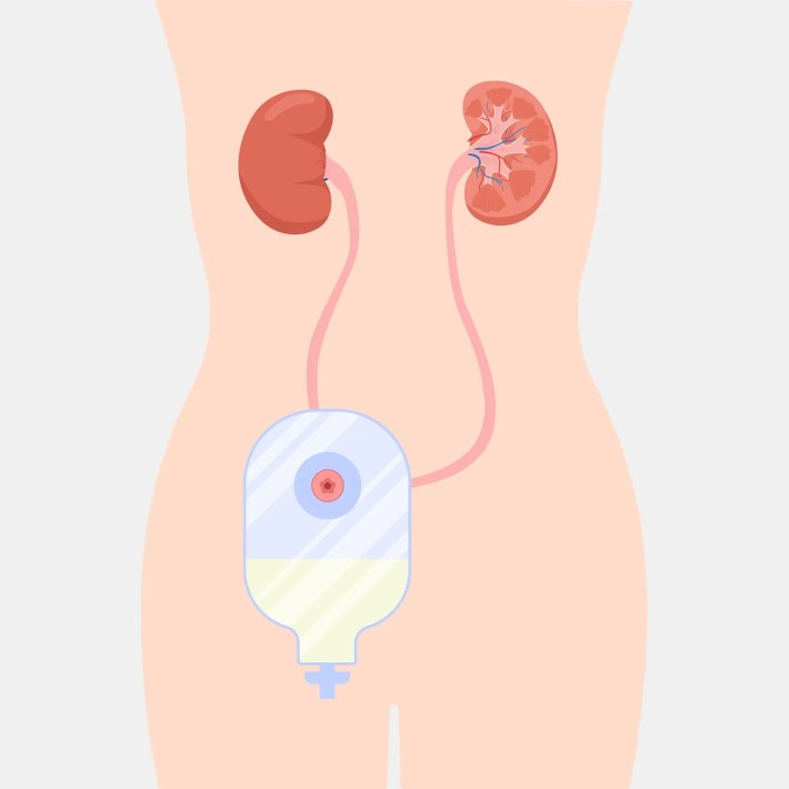 Consulta de estomaterapia | Devicare