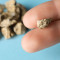 Kidney stone analysis | Devicare