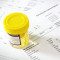 24h Urinalysis Interpretation Consultation and report | Devicare