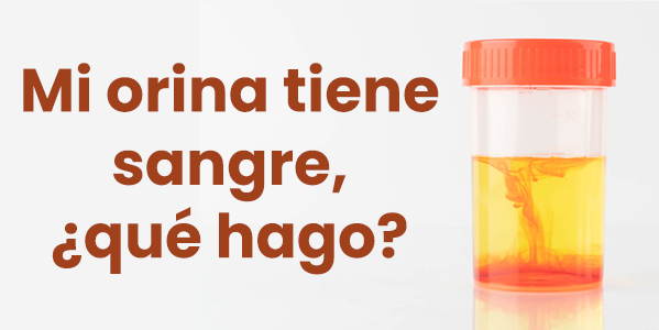 Mi orina tiene sangre, ¿qué hago?
